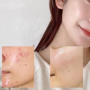 آمپول آنوا تسکین دهنده و مرطوب کننده آنوا Anua حجم 30میلی لیتر